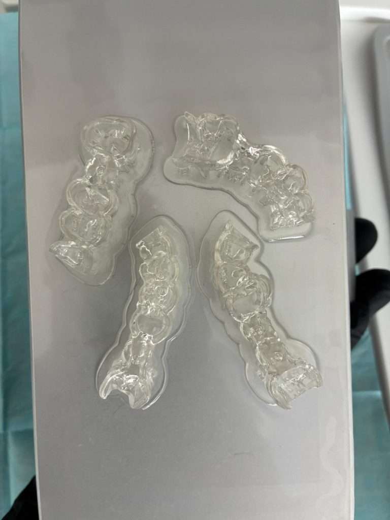 Guías quirúrgicas impresas en 3D antes del posprocesamiento