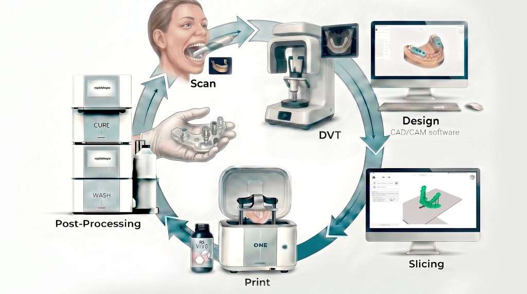 Esquema del proceso de trabajo digital de implantes, creado con ChatGPT